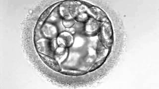 Day 5 full hatched blastocyst under microscope [upl. by Akcimehs]