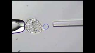 Blastocyst Transfer in IVF Success rate Implantation Procedure Grading Embryo Culture Biopsy [upl. by Fevre]