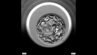 EmbryoScope Embryo Development  Blastocyst [upl. by Lorenza156]