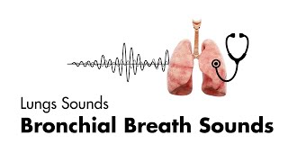 Bronchial Breath Sounds  Lung Sounds  Medzcool [upl. by Kylah]