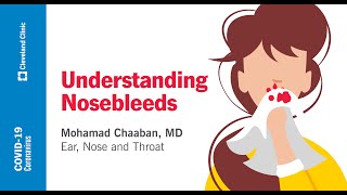 How to treat a nosebleed  NHS [upl. by Tildi]