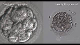 Human Fertilization  Zygote  Blastocyst  Embryology [upl. by Paige]