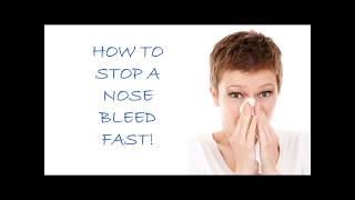 How To Stop A Nosebleed [upl. by Nulubez497]