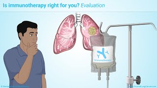 Immunotherapy Treatments for NonSmall Cell Lung Cancer NSCLC [upl. by Lepine492]